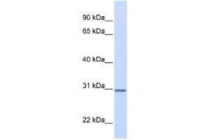 DCI antibody used at 1 ug/ml to detect target protein. (DCI anticorps)