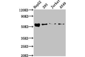 Western Blot Positive WB detected in: HepG2 whole cell lysate, 293 whole cell lysate, Jurkat whole cell lysate, A549 whole cell lysate All lanes: ZDHHC14 antibody at 10. (ZDHHC14 anticorps  (AA 328-453))