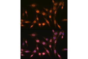 Immunofluorescence analysis of NIH-3T3 cells using PRMT1 Rabbit mAb  at dilution of 1:100 (40x lens).