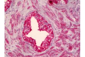 Anti-SMO antibody IHC of human prostate.