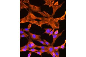 Immunofluorescence analysis of NIH-3T3 cells using VD Rabbit pAb (ABIN7271337) at dilution of 1:100 (40x lens).