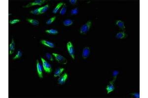 Immunofluorescent analysis of Hela cells using ABIN7153327 at dilution of 1:100 and Alexa Fluor 488-congugated AffiniPure Goat Anti-Rabbit IgG(H+L)
