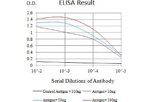 Black line: Control Antigen (100 ng),Purple line: Antigen (10 ng), Blue line: Antigen (50 ng), Red line:Antigen (100 ng)