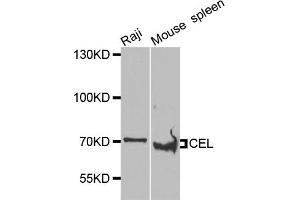 Western blot analysis of extracts of various cell lines, using CEL antibody (ABIN5975616) at 1/1000 dilution. (Cholesterol Esterase anticorps)