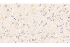 Detection of LAMb2 in Rat Cerebrum Tissue using Polyclonal Antibody to Laminin Beta 2 (LAMb2)