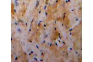 Used in DAB staining on fromalin fixed paraffin-embedded Heart tissue (Galectin 3 anticorps  (AA 1-250))