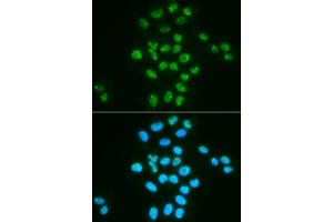 Immunofluorescence analysis of HeLa cells using Bmi1 antibody (ABIN6130877, ABIN6137590, ABIN6137592 and ABIN6217484).