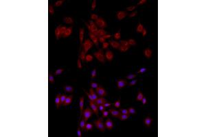 Immunofluorescence analysis of PC-12 cells using GM130 Rabbit pAb (ABIN6129789, ABIN6141264, ABIN6141265 and ABIN6220979) at dilution of 1:100 (40x lens).