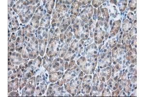 Immunohistochemical staining of paraffin-embedded Human colon tissue using anti-USP5 mouse monoclonal antibody. (USP5 anticorps)