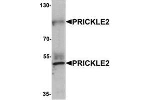 Western blot analysis of PRICKLE2 in A-20 lysate with PRICKLE2 antibody at 1 μg/mL. (PRICKLE2 anticorps  (Middle Region))