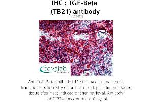 Image no. 2 for anti-TGF-beta (TGFb) antibody (ABIN1723276) (TGF-beta anticorps)