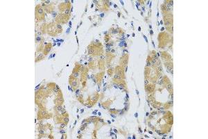 Immunohistochemistry of paraffin-embedded human stomach using STK4 antibody.