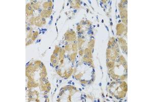 Immunohistochemistry of paraffin-embedded human stomach using STK4 antibody. (STK4 anticorps  (AA 303-487))