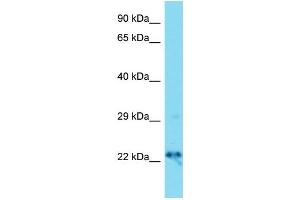 Host: Rabbit  Target Name: Dnajc12  Sample Tissue: Mouse Brain lysates  Antibody Dilution: 1. (DNAJC12 anticorps  (Middle Region))
