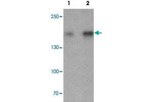 Western blot analysis of Jurkat cell lysate with CRIM2 polyclonal antibody  at (1) 1 and (2) 2 ug/mL. (KCP anticorps  (C-Term))