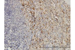 Immunoperoxidase of monoclonal antibody to TIMP2 on formalin-fixed paraffin-embedded human spleen. (TIMP2 anticorps  (AA 27-220))