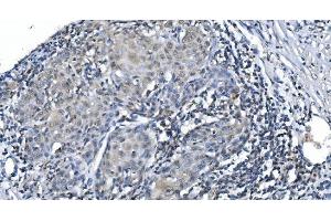 IHC analysis of METTL3 using anti-METTL3 antibody (ABIN7602366).