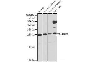 Western blot analysis of extracts of various cell lines using BAK1 Polyclonal Antibody at dilution of 1:1000. (BAK1 anticorps)