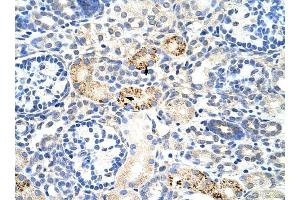 RBM4B antibody was used for immunohistochemistry at a concentration of 4-8 ug/ml to stain Epithelial cells of renal tubule (arrows) in Human Kidney. (RBM4B anticorps  (C-Term))