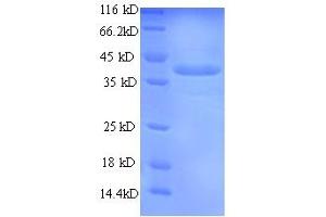 SDS-PAGE (SDS) image for Annexin A1 (ANXA1) (AA 2-346) protein (His tag) (ABIN5709041)