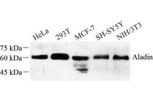 Western blot analysis of Aladin (ABIN7072884) at dilution of 1: 500 (Adracalin anticorps)