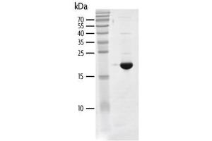 Recombinant BRD4 (44-168) protein gel. (BRD4 Protein (AA 44-168) (His tag,DYKDDDDK Tag))