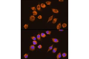 Immunofluorescence analysis of L929 cells using NAGA Rabbit pAb (ABIN6133352, ABIN6144342, ABIN6144343 and ABIN6225273) at dilution of 1:100 (40x lens). (NAGA anticorps  (AA 312-411))