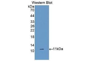 Western Blotting (WB) image for anti-Diazepam Binding Inhibitor (DBI) (AA 2-87) antibody (ABIN1176163) (Diazepam Binding Inhibitor anticorps  (AA 2-87))