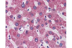 Immunohistochemistry (IHC) image for anti-RHBG (C-Term) antibody (ABIN2783778)