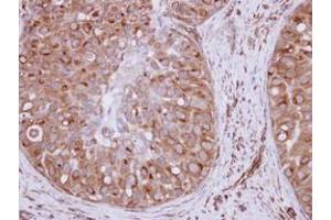 Image no. 1 for anti-Exportin 6 (XPO6) (AA 135-383) antibody (ABIN1501767)