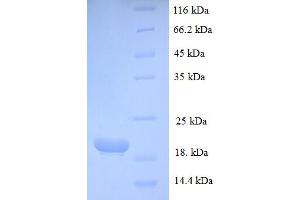 SDS-PAGE (SDS) image for Parathyroid Hormone 1 Receptor (PTH1R) (AA 37-175), (Isoform 2) protein (His tag) (ABIN5710181)