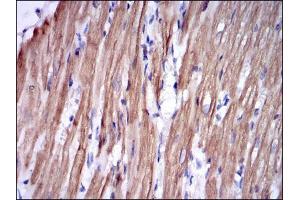 Immunohistochemical analysis of paraffin-embedded rabbit cardiac muscle tissues using TNNI2 mouse mAb with DAB staining. (TNNI2 anticorps)
