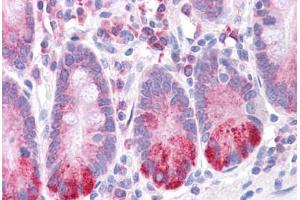 Human Small Intestine: Formalin-Fixed, Paraffin-Embedded (FFPE)