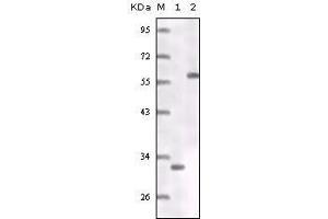 Western Blot showing ER antibody truncated ER recombinant protein (1) MCF-7 cell lysates (2). (Estrogen Receptor alpha anticorps)