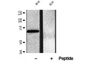 Western blot analysis of extracts of HEK-293 cells, using FKBP65 antibody.