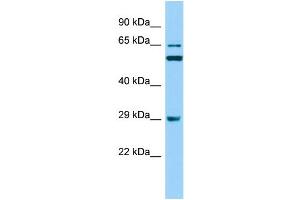 Host: Rabbit Target Name: RAB19 Sample Type: RPMI-8226 Whole Cell lysates Antibody Dilution: 1. (RAB19 anticorps  (N-Term))