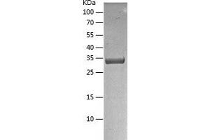 Western Blotting (WB) image for 5'-Nucleotidase, Cytosolic III-Like (NT5C3L) (AA 1-300) protein (His-IF2DI Tag) (ABIN7121624)
