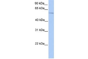 WB Suggested Anti-PLAG1 Antibody Titration:  0. (PLAG1 anticorps  (N-Term))