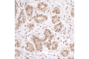 Immunohistochemistry (IHC) image for anti-Fused in Sarcoma (FUS) (AA 1-50) antibody (ABIN7454969)