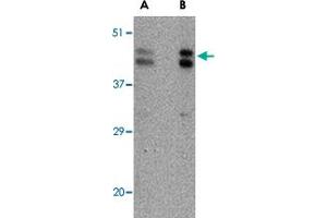 Western blot analysis of FBXL20 in A-20 cell lysate with FBXL20 polyclonal antibody  at (A) 0.