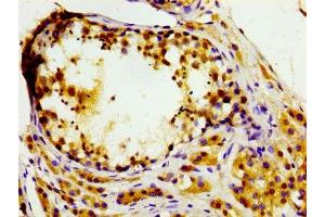 anti-Microtubule Associated serine/threonine Kinase-Like (MASTL) (AA 612-740) antibody