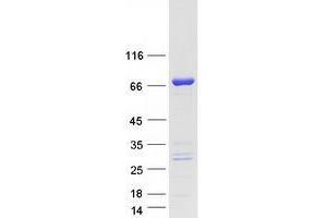 Validation with Western Blot