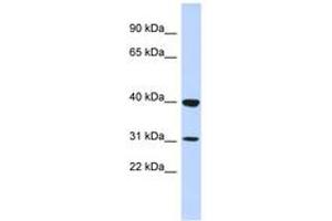 Image no. 1 for anti-Zinc Finger Protein 660 (ZNF660) (N-Term) antibody (ABIN6742930) (ZNF660 anticorps  (N-Term))