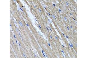 Immunohistochemistry of paraffin-embedded Mouse heart using TNFAIP6 Polyclonal Antibody at dilution of 1:100 (40x lens).