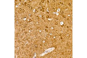 Immunohistochemistry of paraffin-embedded mouse brain using ENO2 Rabbit mAb (ABIN7266959) at dilution of 1:100 (40x lens).