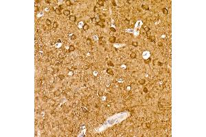 Immunohistochemistry of paraffin-embedded mouse brain using ENO2 Rabbit mAb (ABIN7266959) at dilution of 1:100 (40x lens). (ENO2/NSE anticorps)