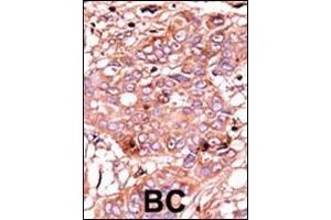 anti-C-Abl Oncogene 1, Non-Receptor tyrosine Kinase (ABL1) (pTyr251) antibody