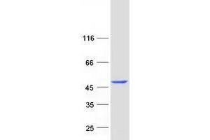 Validation with Western Blot