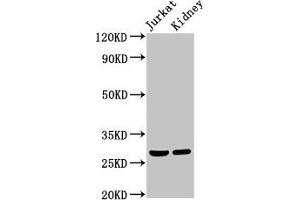 Western Blot Positive WB detected in: Jurkat whole cell lysate, Rat kidney tissue All lanes: MSX2 antibody at 2 μg/mL Secondary Goat polyclonal to rabbit IgG at 1/50000 dilution Predicted band size: 29 kDa Observed band size: 29 kDa (Msx2/Hox8 anticorps  (AA 50-120))