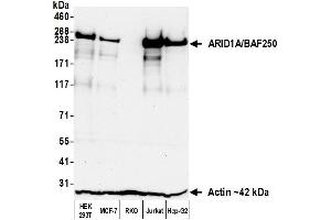 Western Blotting (WB) image for anti-AT Rich Interactive Domain 1A (SWI-Like) (ARID1A) (AA 750-800) antibody (ABIN7795677) (Recombinant ARID1A anticorps  (AA 750-800))